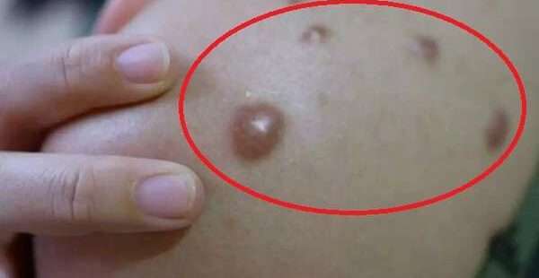 மினுவாங்கொடையில் அதிகரிக்கும் ஆபத்து