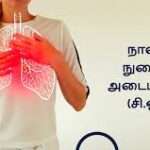 COPD நோய் குறித்து வைத்தியர்களின் அறிவுறுத்தல்