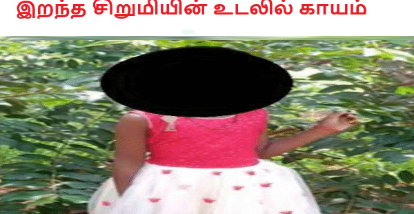இறந்த சிறுமியின் உடலில் காயம்