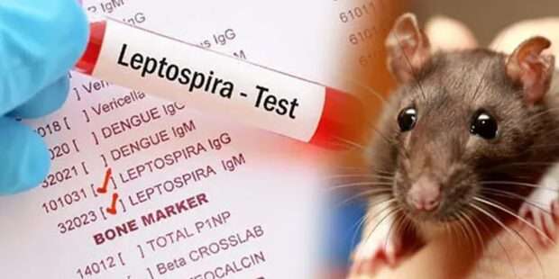 நாட்டில் எலிக் காய்ச்சல்