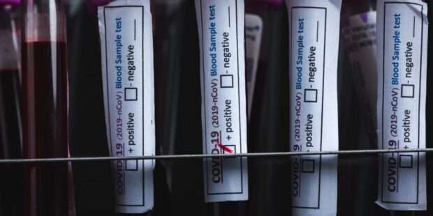 HKU5 வௌவால் வைரஸ் விஞ்ஞானிகள் எச்சரிக்கை