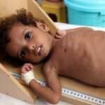 காசாவில் பசியால் இறந்தவர்களின் எண்ணிக்கை 428 ஆக உயர்வு