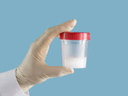 தேவையை பூர்த்தி செய்யும் வகையில் விந்தணு தானம்